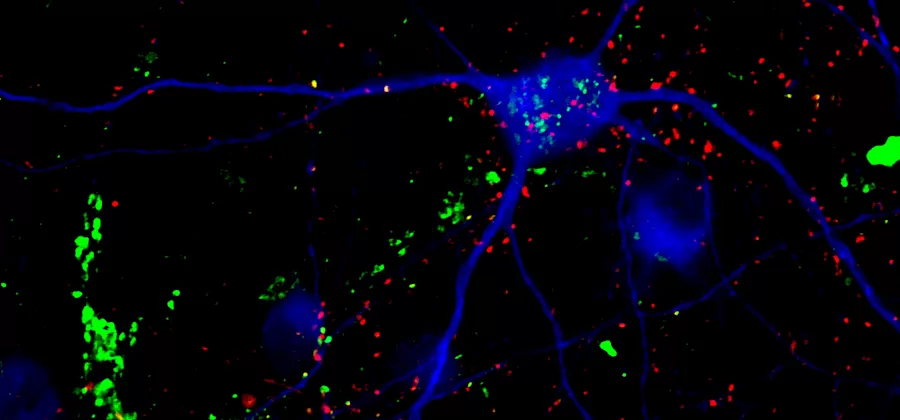 hero-harnessing-exosomes-as-a-therapeutic-for-rett-syndrome